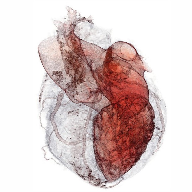 Heart Failure Prediction Project